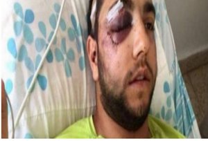 درزي يخدم في جيش الاحتلال فقد وعيه جراء ضربه لتحدثه العربية