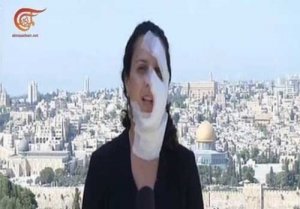 إصابة مراسلة الميادين أثناء تغطية اقتحام قوات الاحتلال منزل الشهيد فادي علون في العيسوية